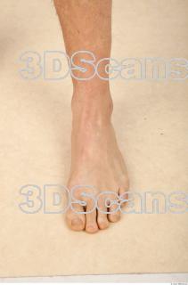 Photo reference of foot 0002